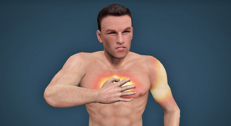Szívinfarktus