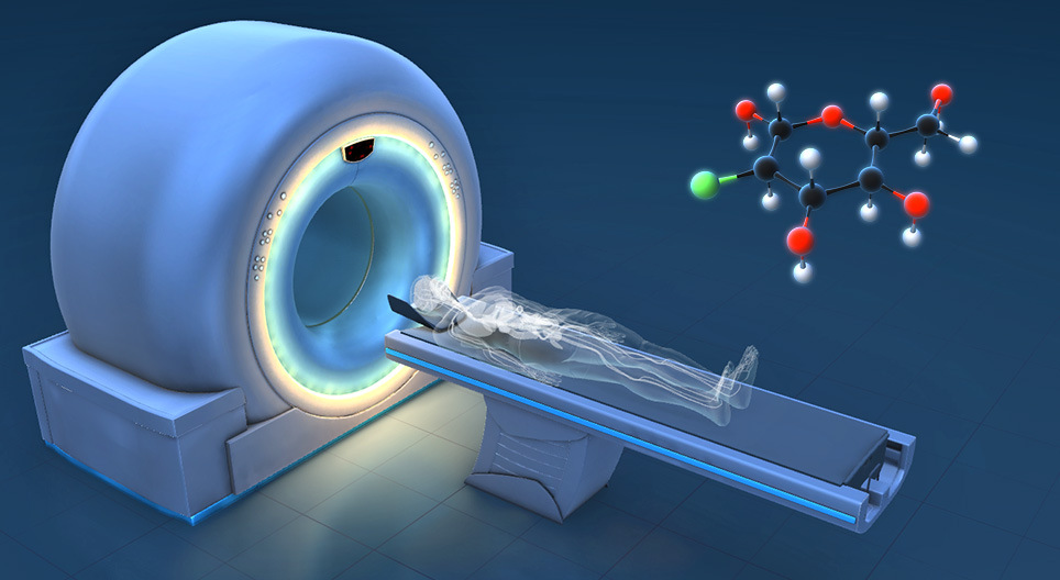 Hogyan működik a PET-CT?