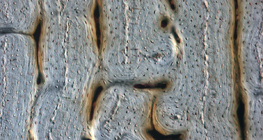Csont (hosszanti csiszolat)